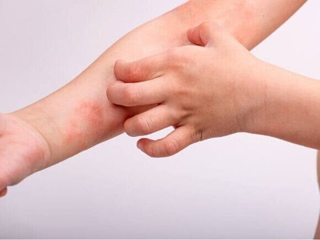 O Papel dos Diferentes Componentes do Leite na Reação - inspiração 1