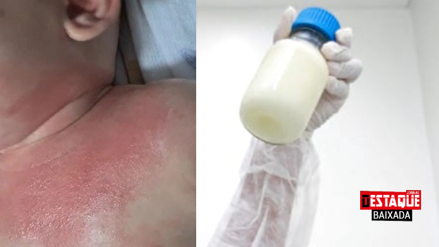 O Teste de Desafio: O Padrão Ouro para o Diagnóstico - inspiração 1