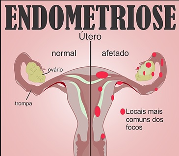 Planejamento de Refeições: Conquistando o Equilíbrio - inspiração 2