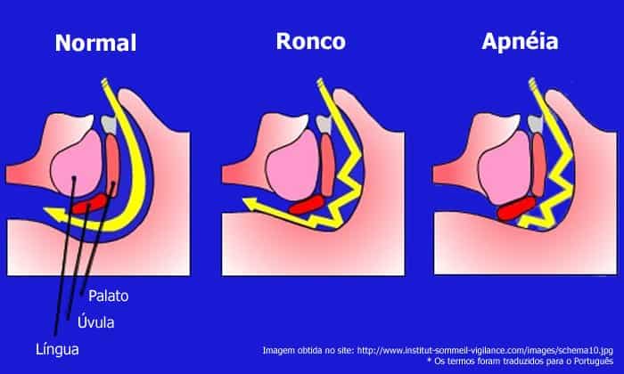 Tratamentos Disponíveis: Opções Que Funcionam - inspiração 2