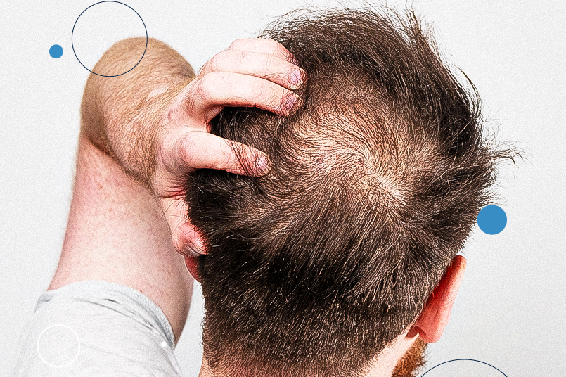 Mudanças Sazonais: O Impacto do Clima nos Fios - inspiração 2