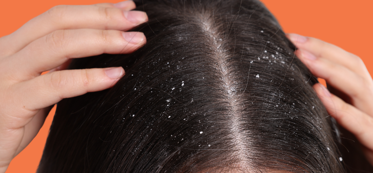 Uso de Produtos Inadequados: Atenção aos Ingredientes - inspiração 1