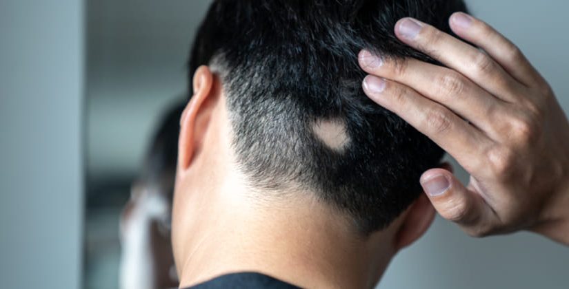 Tratamentos Capilares Agressivos: Babyliss, Chapinha e Química Pesada - inspiração 1