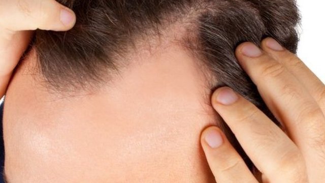 Tratamentos Capilares Agressivos: Babyliss, Chapinha e Química Pesada - inspiração 2