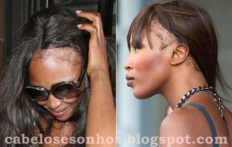 Alimentação e Estilo de Vida: O Papel da Saúde Geral nos Cabelos - inspiração 1