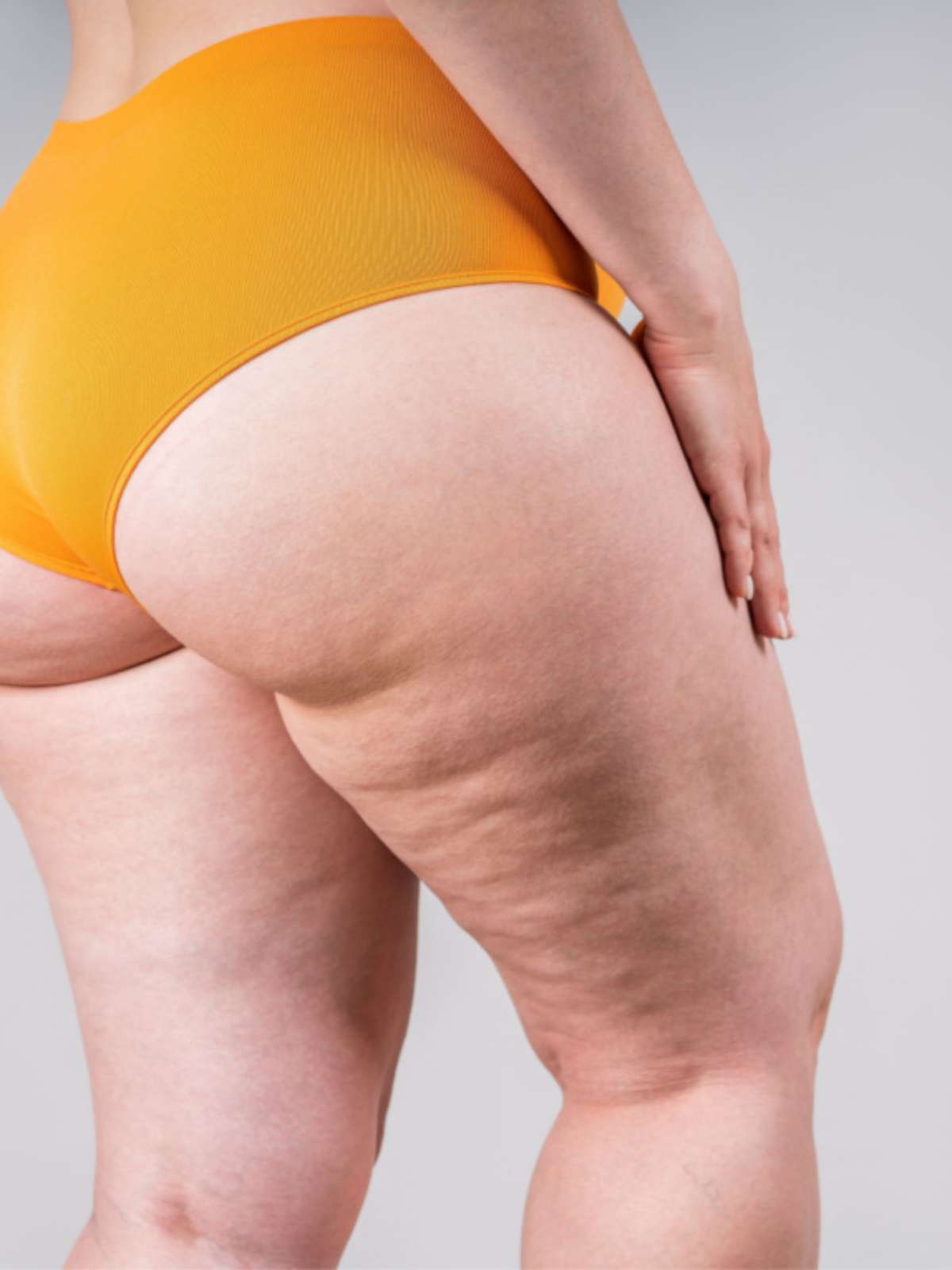 Cuidados Diários Simples Que Afastam a Celulite - inspiração 1