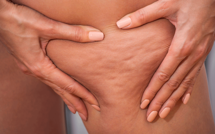 Exercícios Físicos: Aliados Poderosos na Luta Contra os 'Furos' - inspiração 2