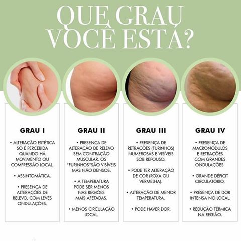 Massagem: Um Ritual de Beleza Que Reduz a Aparência da Celulite - inspiração 1
