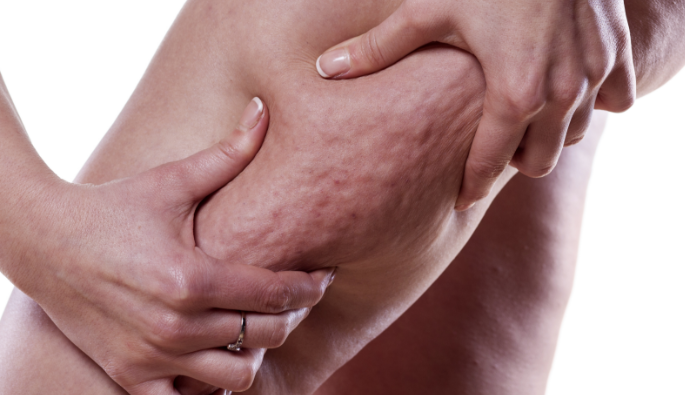 Tratamentos Estéticos: Quando e Quais Valem a Pena Considerar - inspiração 2