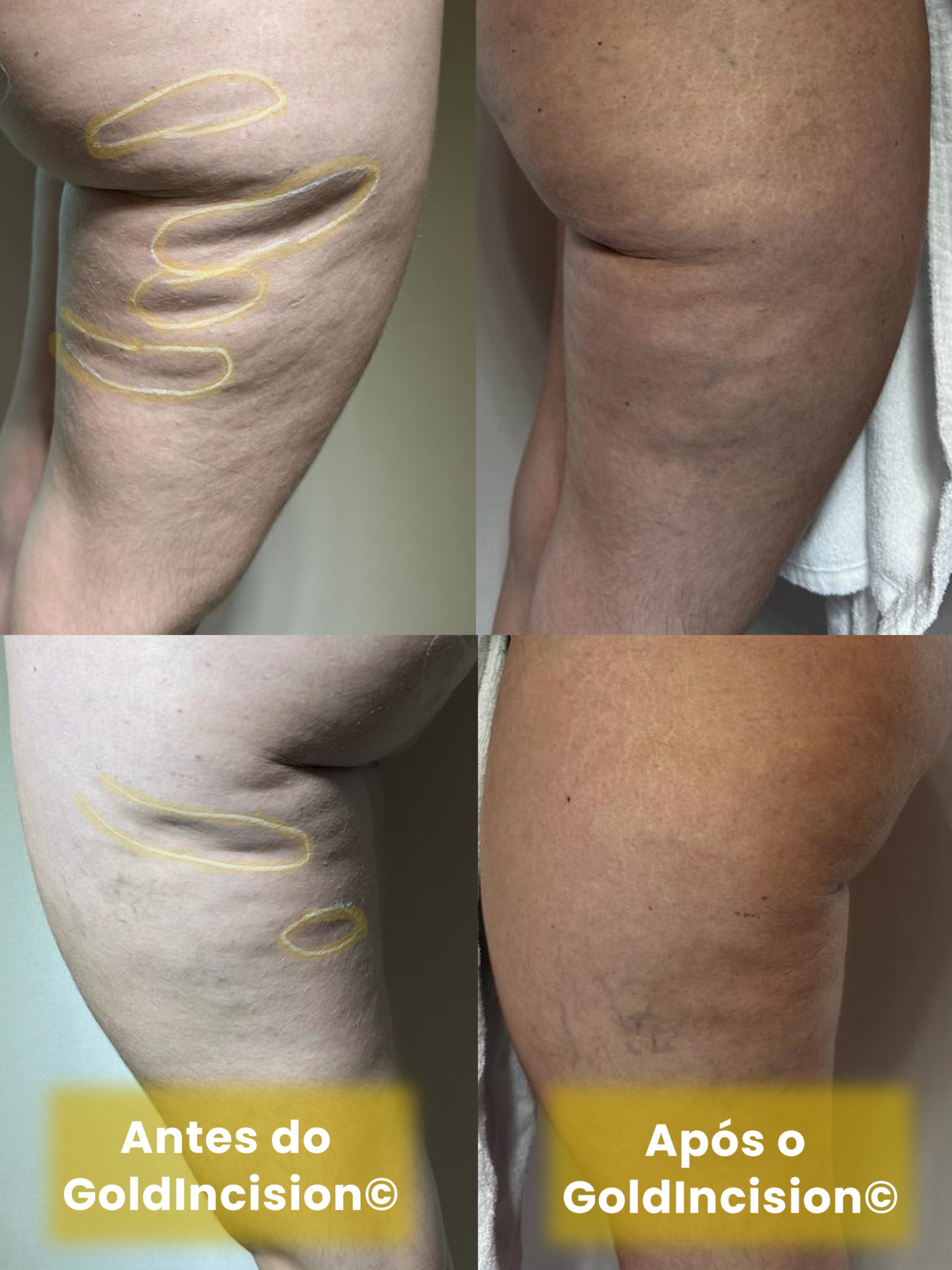 Genética e Hormônios: Fatores Que Você Não Controla, Mas Pode Gerenciar - inspiração 2