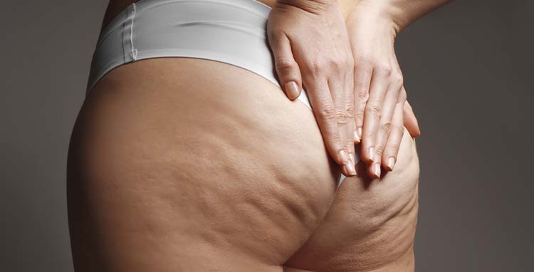 Drenagem Linfática: Benefícios e Quando Apostar - inspiração 1