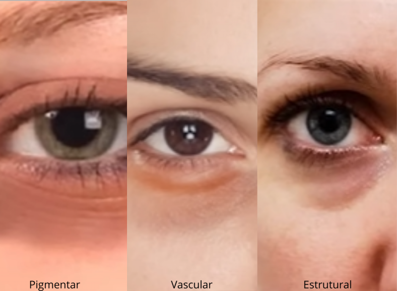 Tratamentos profissionais: Quando a dermatologia entra em cena - inspiração 2