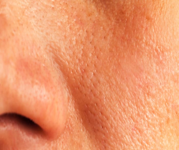 Quando Procurar Ajuda Profissional: Dermatologistas São Aliados - inspiração 2