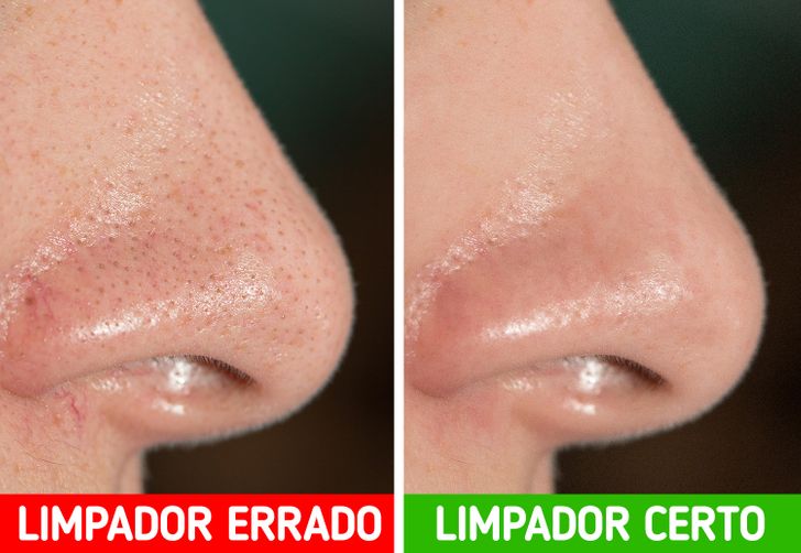 Tratamentos Tópicos Poderosos: Ácidos Que Fazem Milagres - inspiração 2