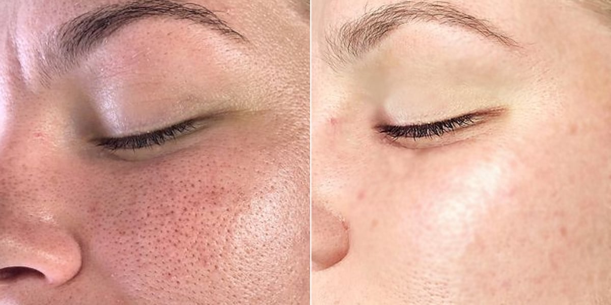 Máscaras Faciais: Um Reforço Efetivo e Relaxante - inspiração 2