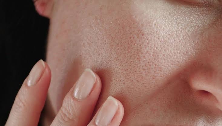 Dieta e Bem-Estar: Nutrição Que Reflete na Pele - inspiração 1