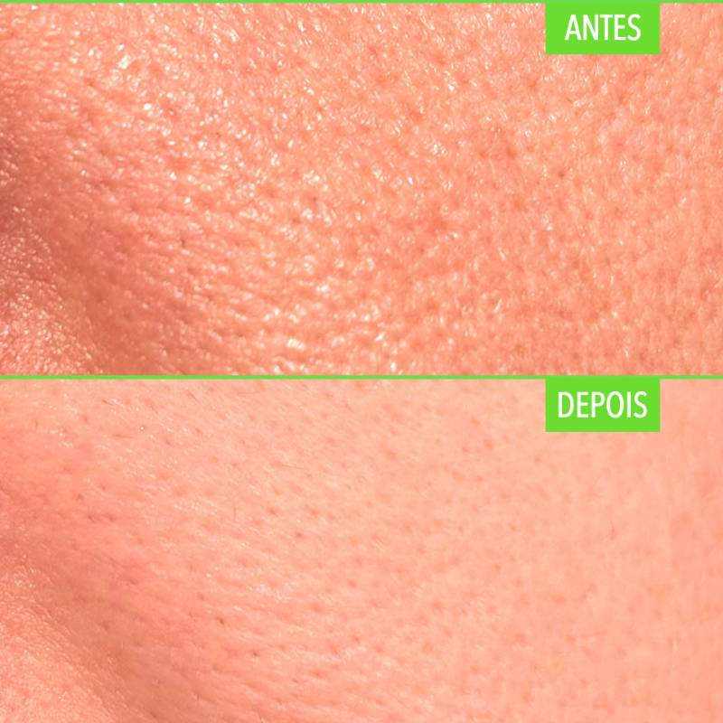 Dieta e Bem-Estar: Nutrição Que Reflete na Pele - inspiração 2