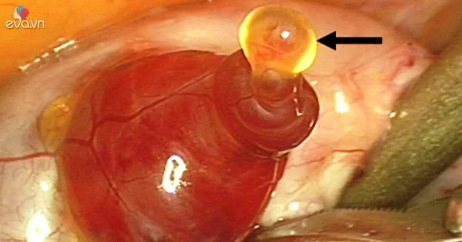 Quando Buscar Ajuda Profissional: Um Guia Essencial - inspiração 1