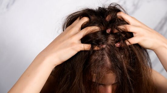 A Alimentação que Transforma: Nutrientes Essenciais para o Crescimento Capilar - inspiração 1