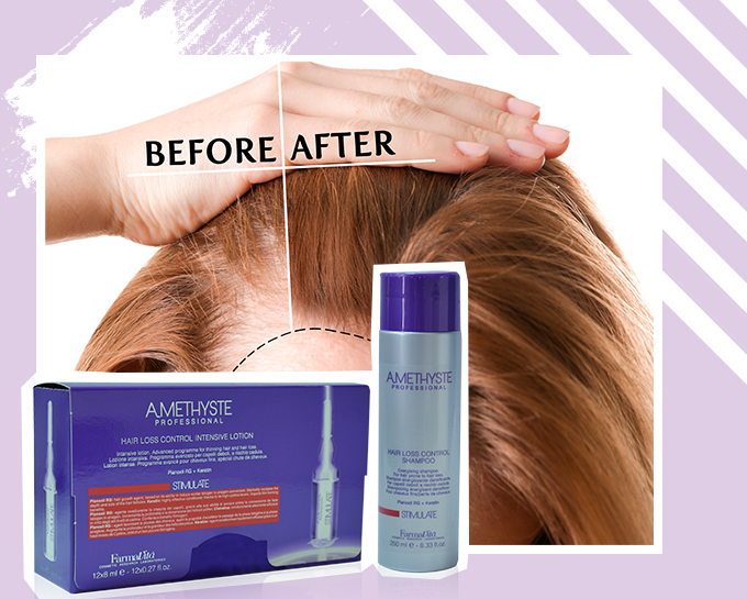 Estresse e Sono: Fatores Cruciais que Influenciam o Desenvolvimento do Cabelo - inspiração 2