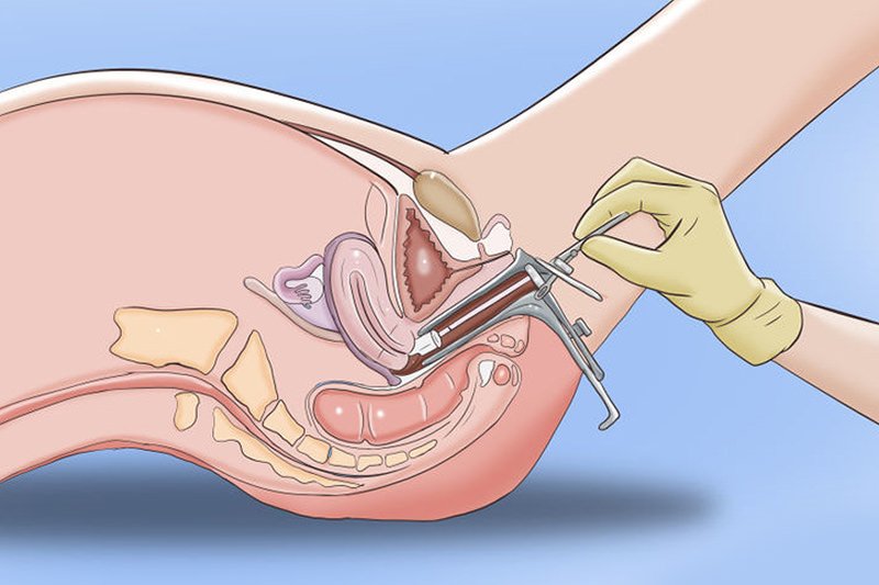 Pós-Exame Papanicolau: Cuidados e Recomendações - inspiração 2