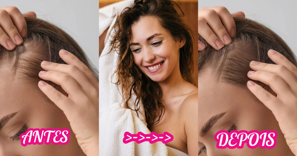 Tratamentos Caseiros Poderosos: Receitas Simples para Potencializar o Crescimento - inspiração 1