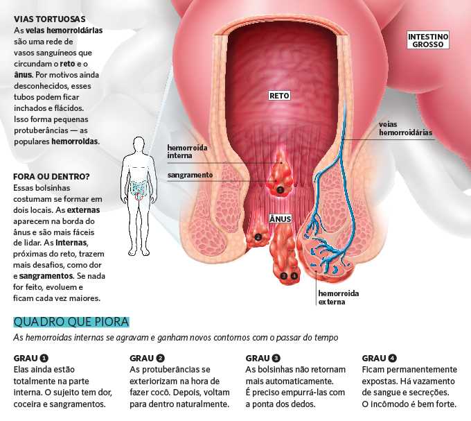A Importância dos Grãos Integrais no Seu Dia a Dia - inspiração 2