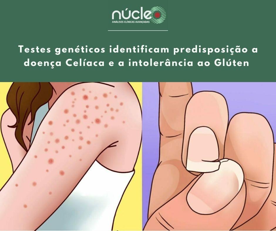 Dores de Cabeça e Fadiga Mental: O Impacto Invisível - inspiração 1