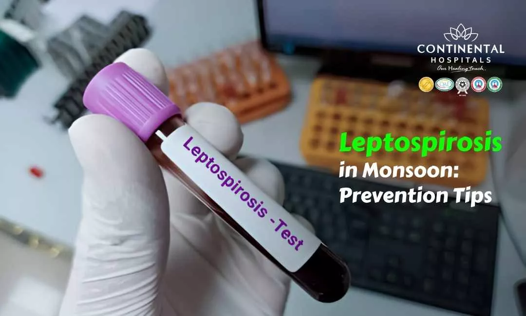 Consulte um Nutricionista: Orientação Personalizada Faz a Diferença - inspiração 1