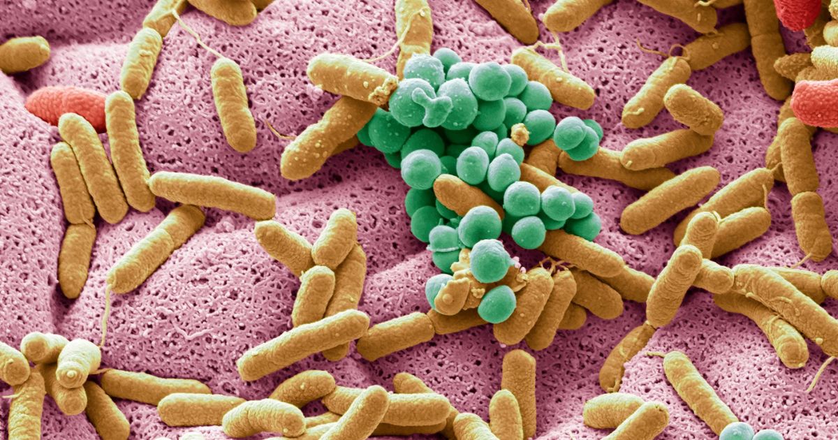 Os Vilões da Sua Flora: O Que Evitar no Dia a Dia - inspiração 2