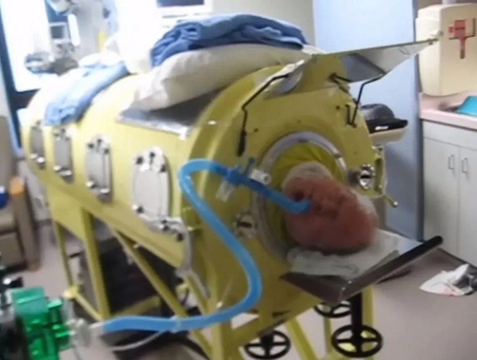 Ligas de Cobalto-Cromo: Força Extra para Situações Específicas - inspiração 2