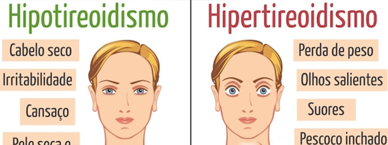 O Alerta do Hipertireoidismo: Reconhecendo os Indicativos de Excesso de Hormônio - inspiração 2