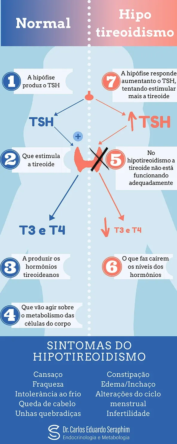 A Fadiga que Não Passa: O Exaustão Marcante no Hipotireoidismo - inspiração 2