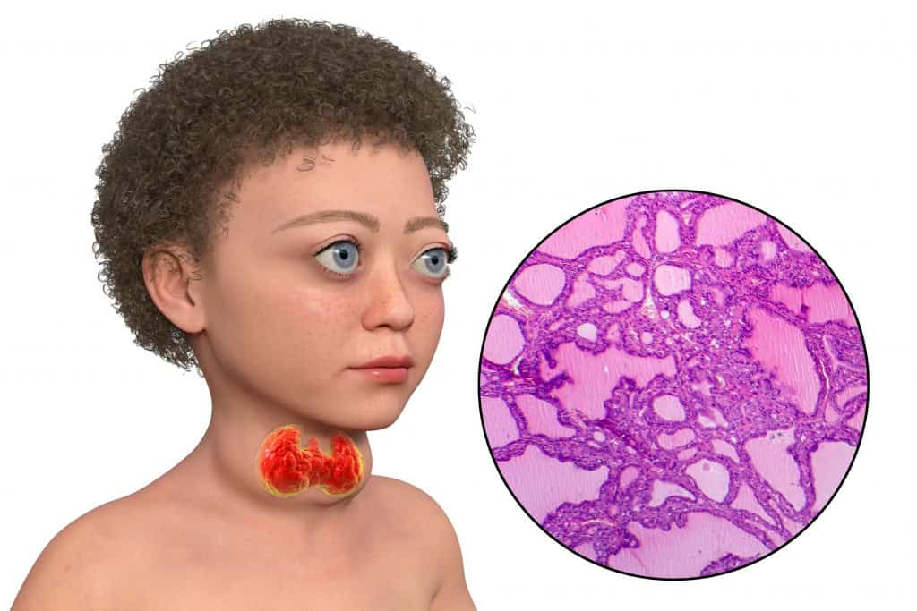 O Ritmo do Intestino: Constipação ou Diarreia Frequente? - inspiração 1