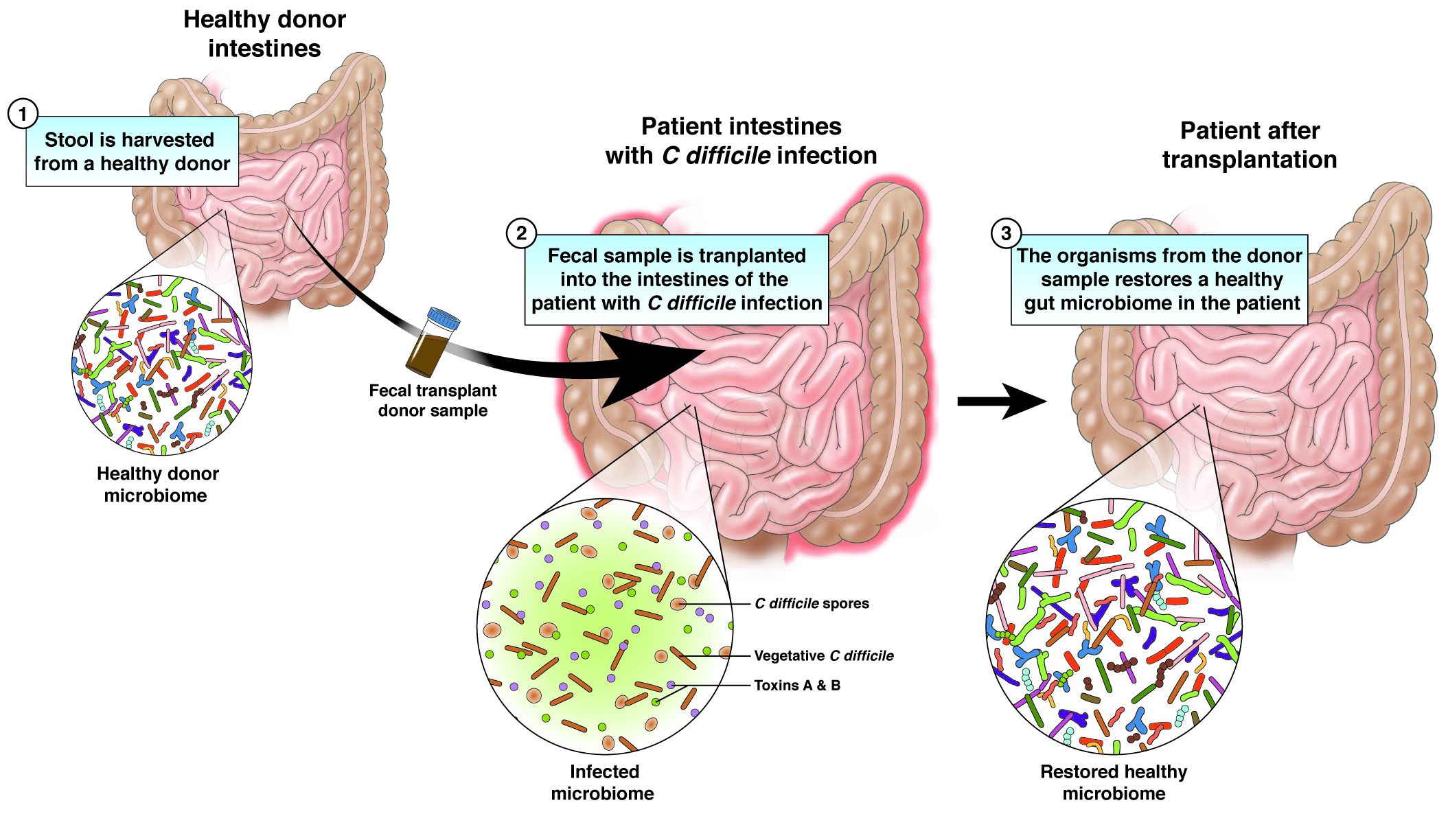 Entendendo a Microbiota: Mais Que Bactérias, Um Ecossistema Essencial - inspiração 2