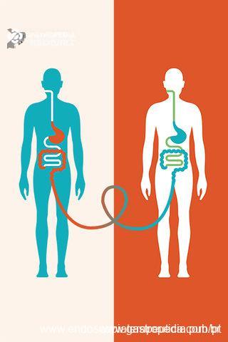 O Que é o Transplante de Microbiota e Como Funciona? - inspiração 1