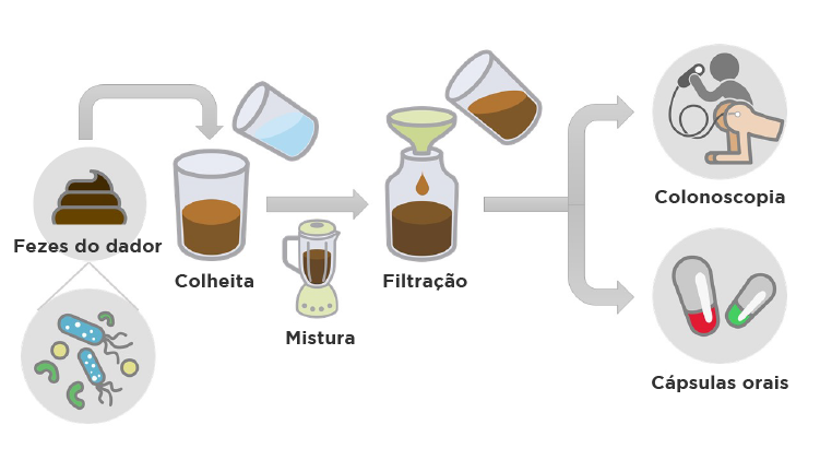 O Que é o Transplante de Microbiota e Como Funciona? - inspiração 2