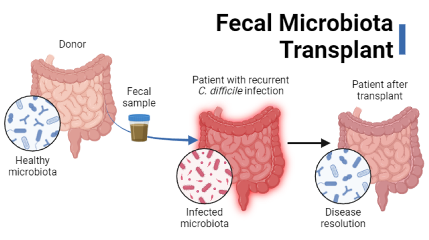 Pós-Transplante: Cuidados e Recuperação Essenciais - inspiração 2
