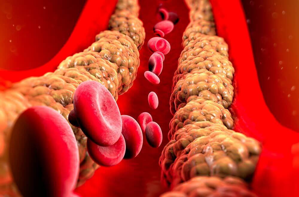 Identificando o que são triglicerídeos de forma clara - inspiração 2