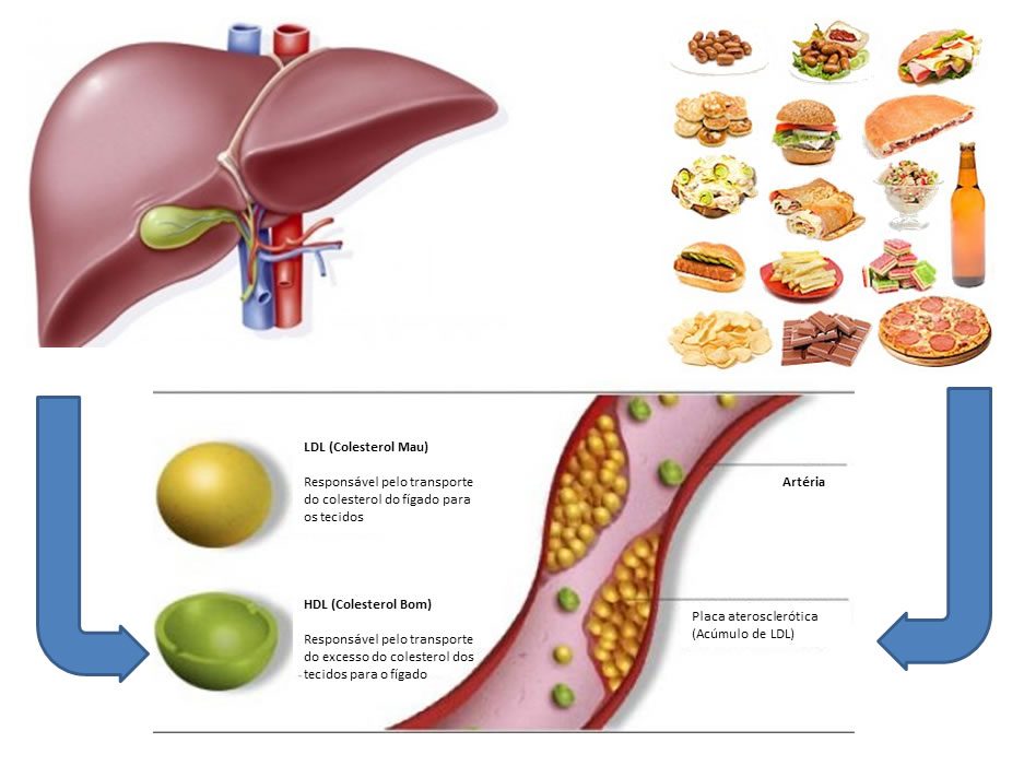 Como os triglicerídeos afetam sua saúde - inspiração 1