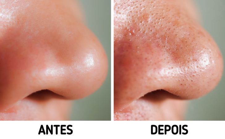 Ingredientes Potencialmente Irritantes: O Que Ficar de Olho - inspiração 2