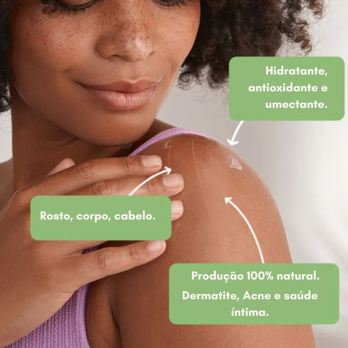 Prevenção de Estrias e Cicatrizes - inspiração 1