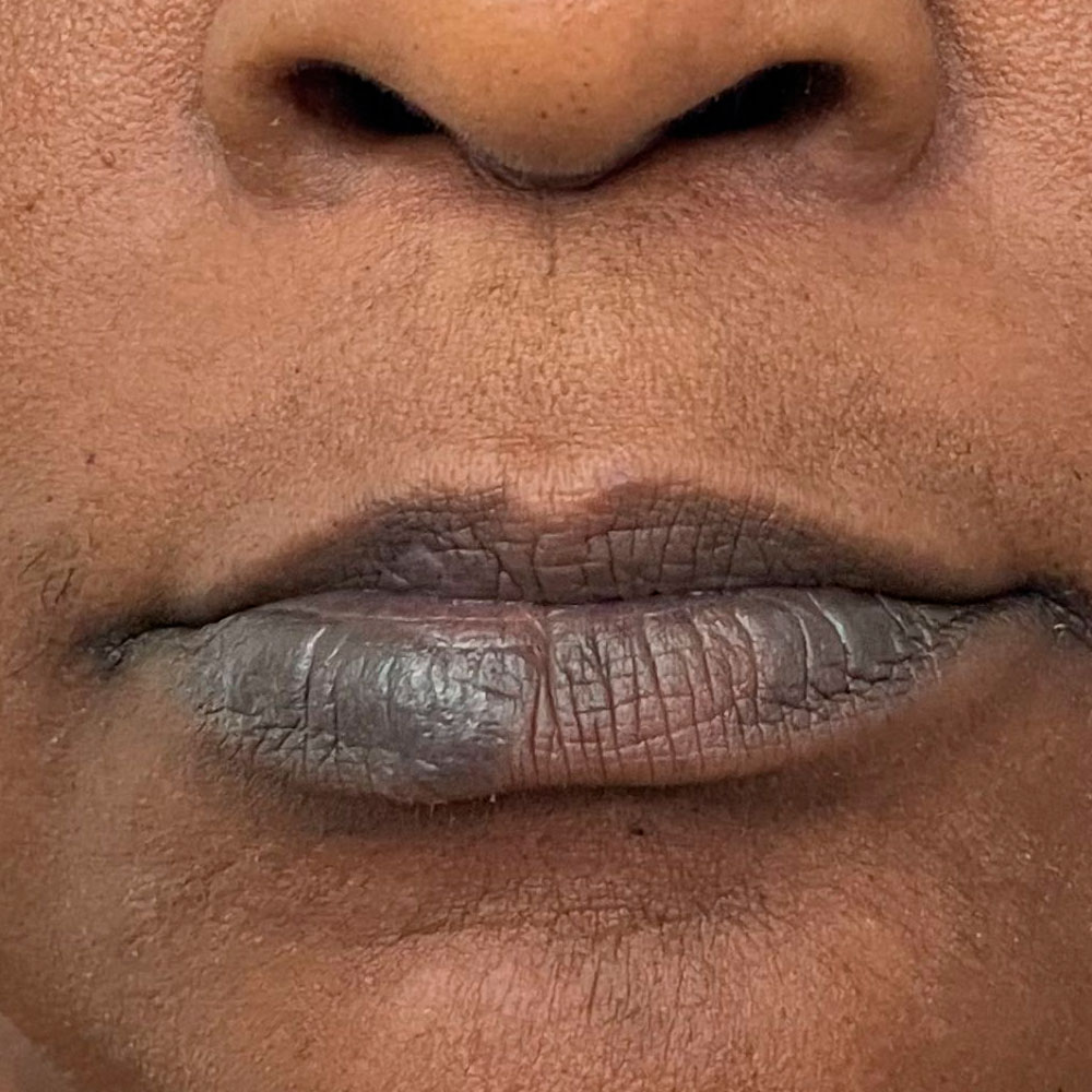 Os 10 ingredientes mais comuns em batons que causam alergia