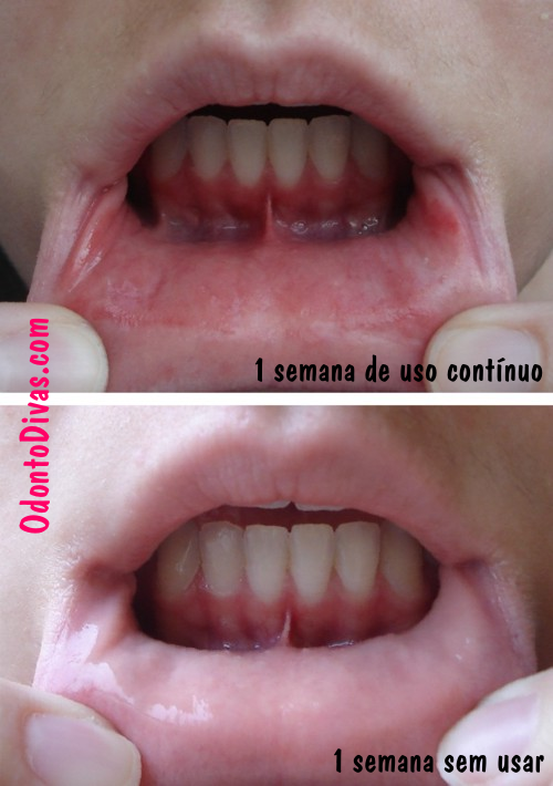 A importância da consulta dermatológica para alergias de pele e lábios