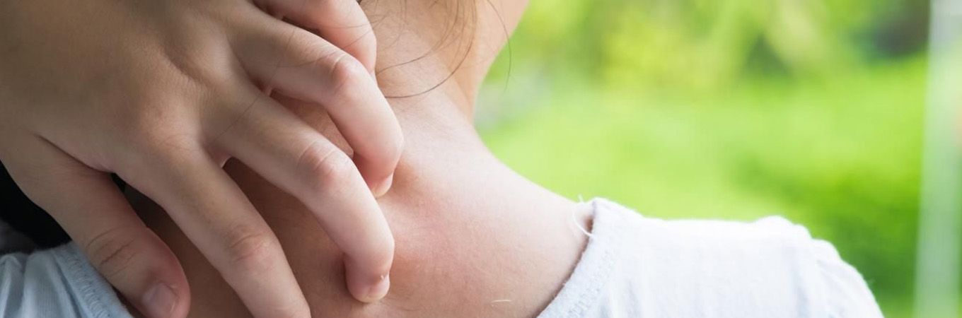 alergia ao trigo em crianças