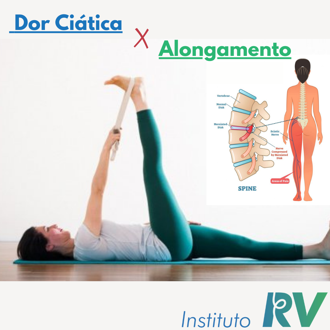 alongamento para ciatalgia