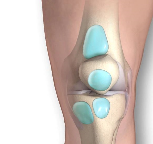 alimentos anti-inflamatórios para bursite