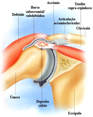 bursite alimentação