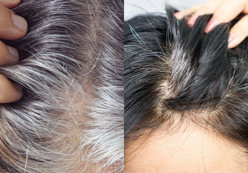 Greyverse funciona? Análise completa do tratamento anti-grisalho