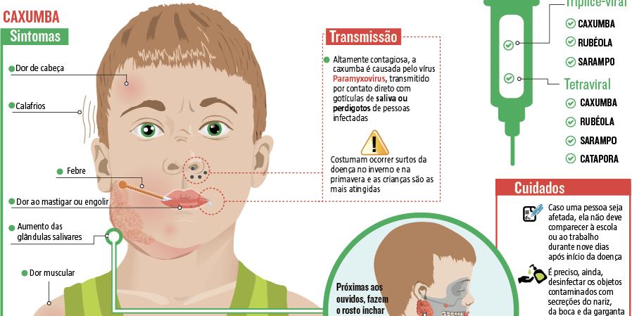 Como Prevenir a Caxumba: Vacinação e Hábitos Saudáveis